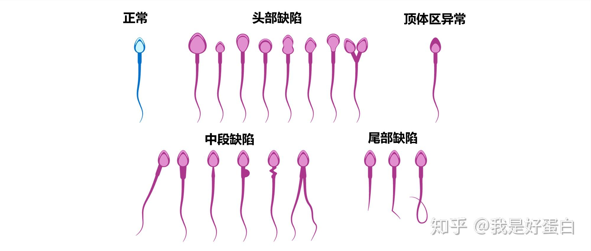 正常形态精子占比高于4％时，认为样品正常。低于此值为“畸形精子症”。如何提高精子质量呢？1. 合理膳