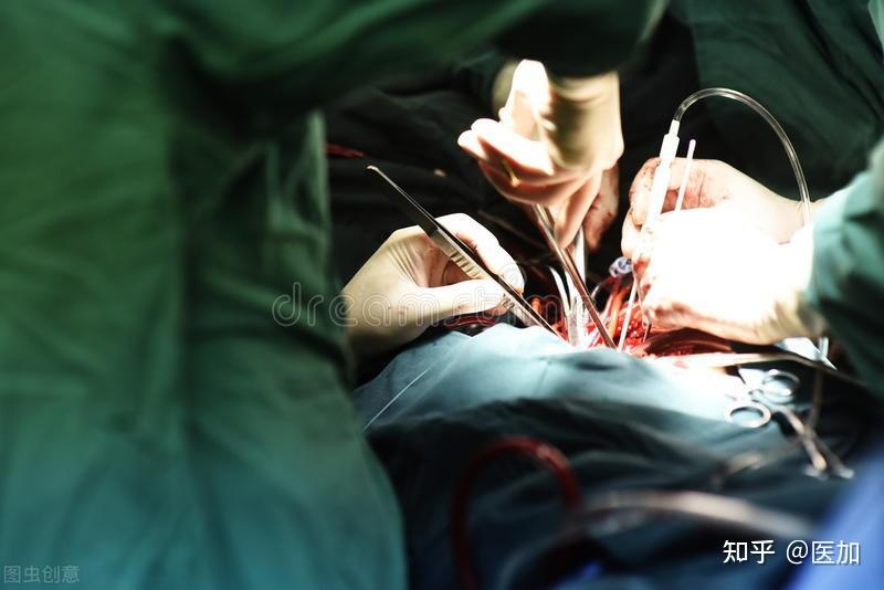 手术高频电刀设备的发展和应用