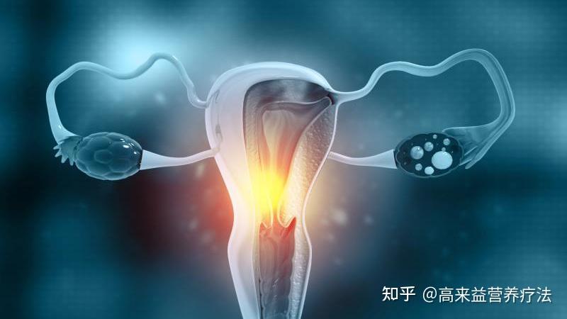 震撼的子宫内膜炎症有什么症状的图像