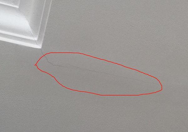 双眼皮的价格_埋线双眼皮价格_双眼皮价格表图片