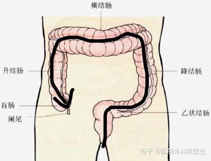回肠和结肠的位置图片图片