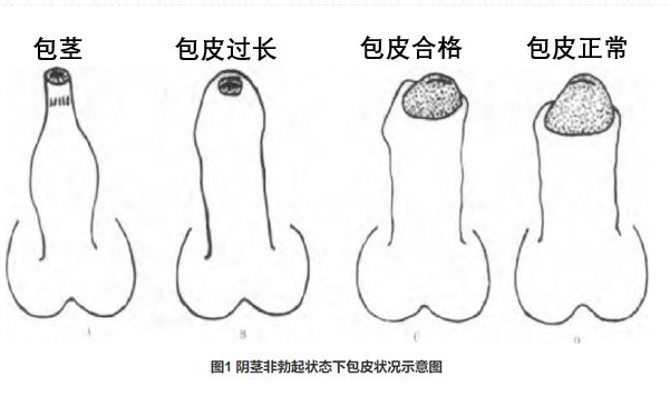 男性的包皮通常是指阴茎上延伸至龟头外约1cm的皮肤,它可以保护尿道口