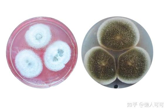 脚气是什么你认识真菌吗