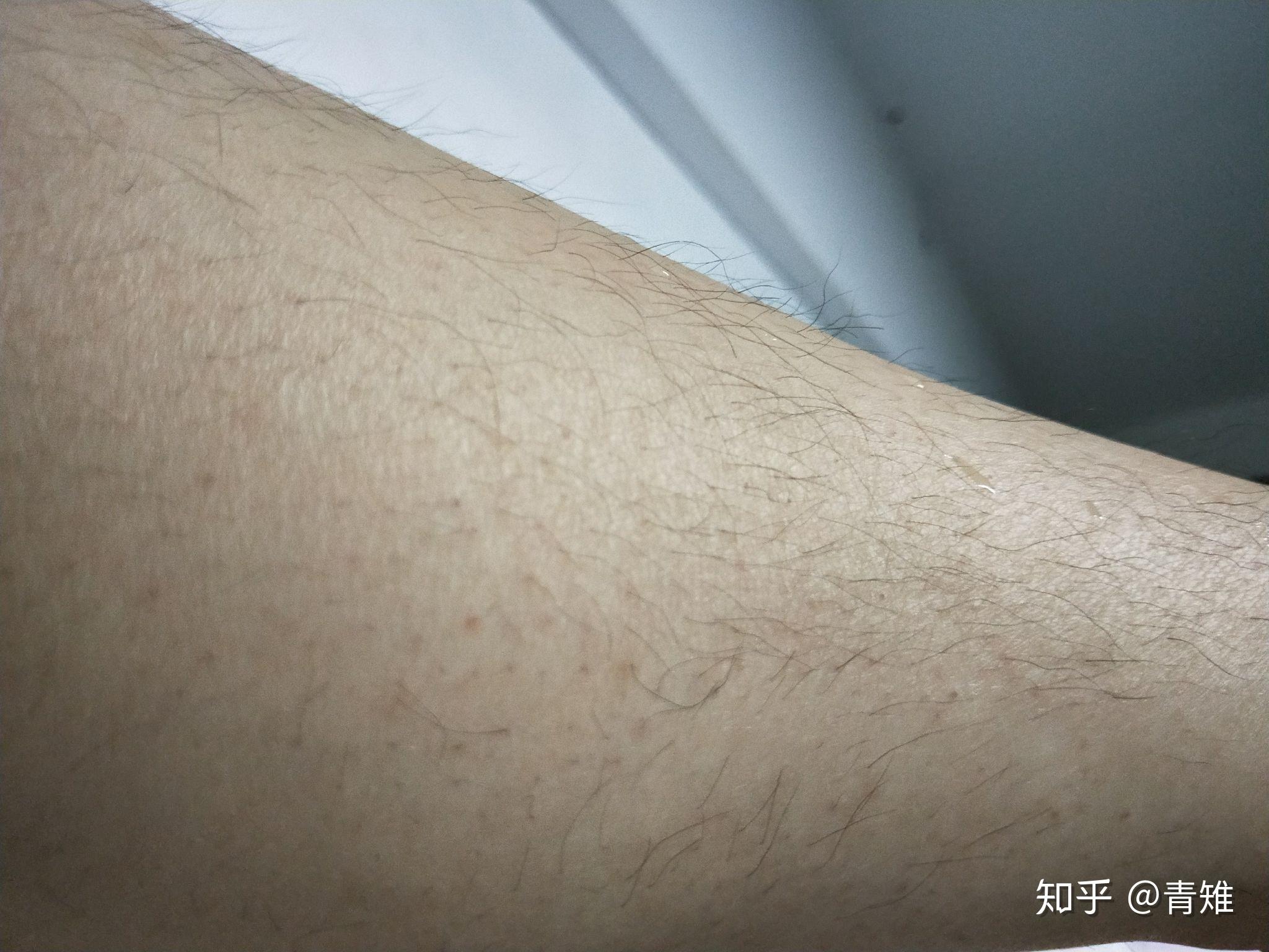 女生腿毛旺盛是怎样的人生体验