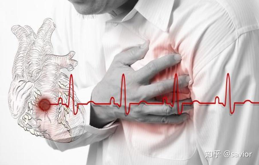 房颤系列(一)——心房颤动的社会危害性