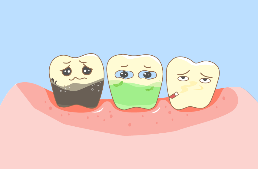 外源性的牙齿变黄