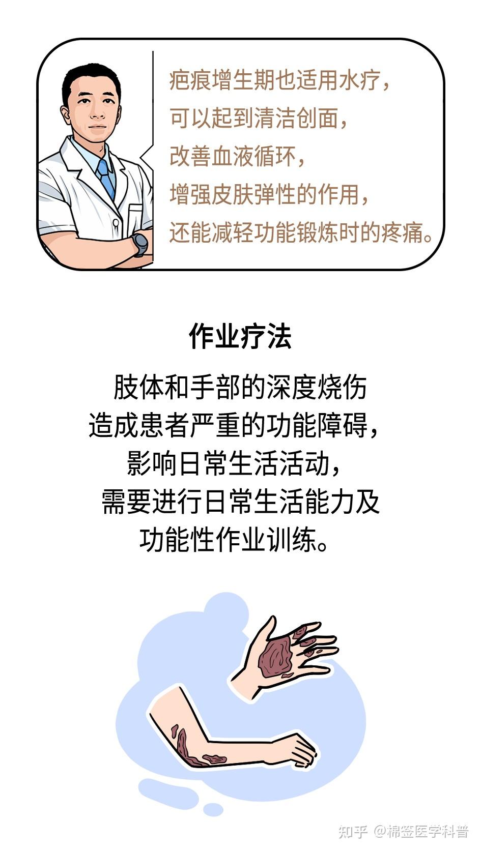 烧伤后如何康复?看这篇就够了! - 知乎