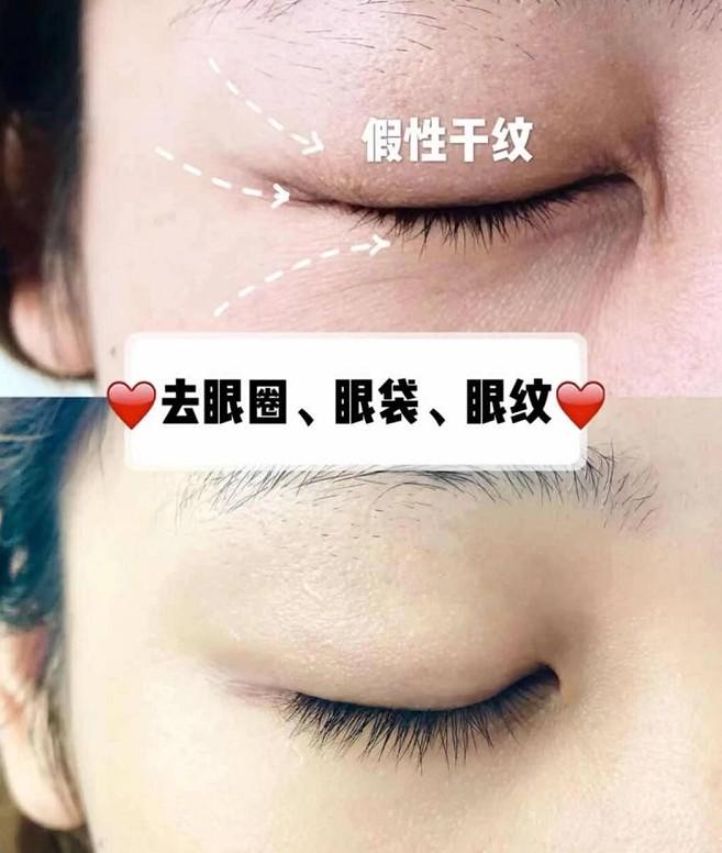 v2-b3c3d8003fabef2207d1fa894247d403_1440w.jpg?source=172ae18b