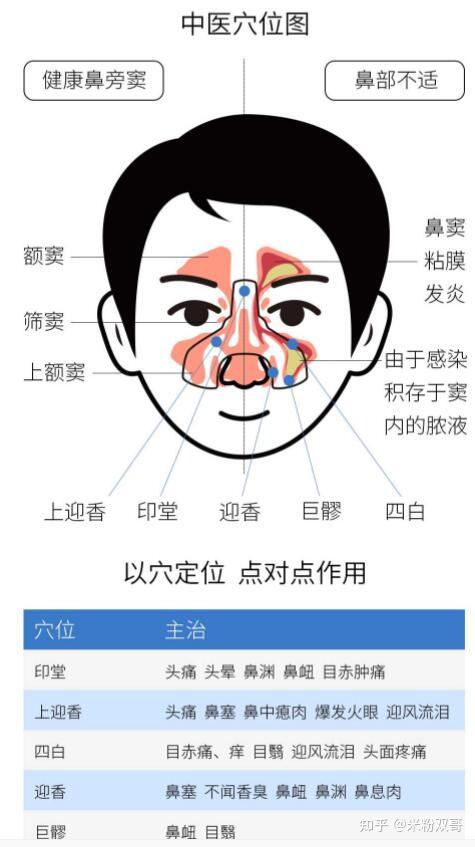 鼻子黎氏区准确位置图图片