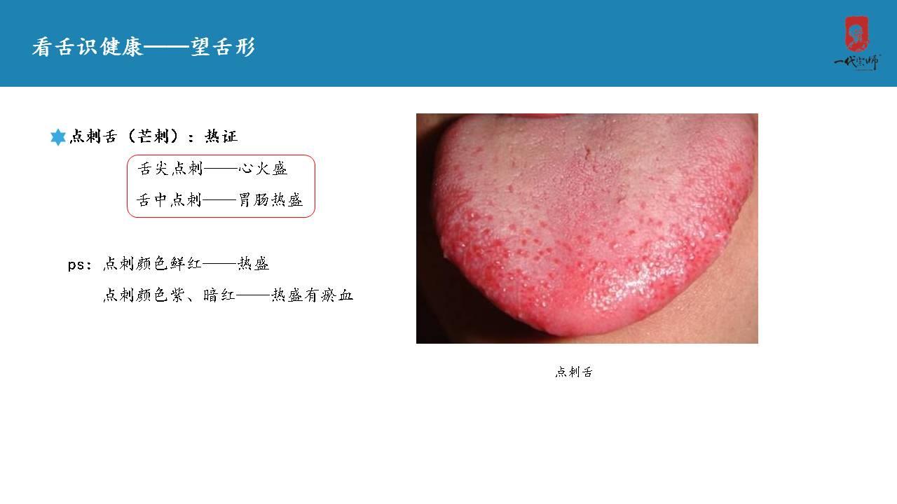 正常的舌苔是怎样的？ - 知乎