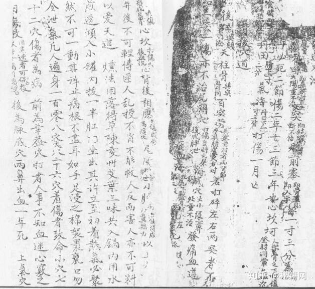 《内家法字门点穴秘籍》 - 知乎