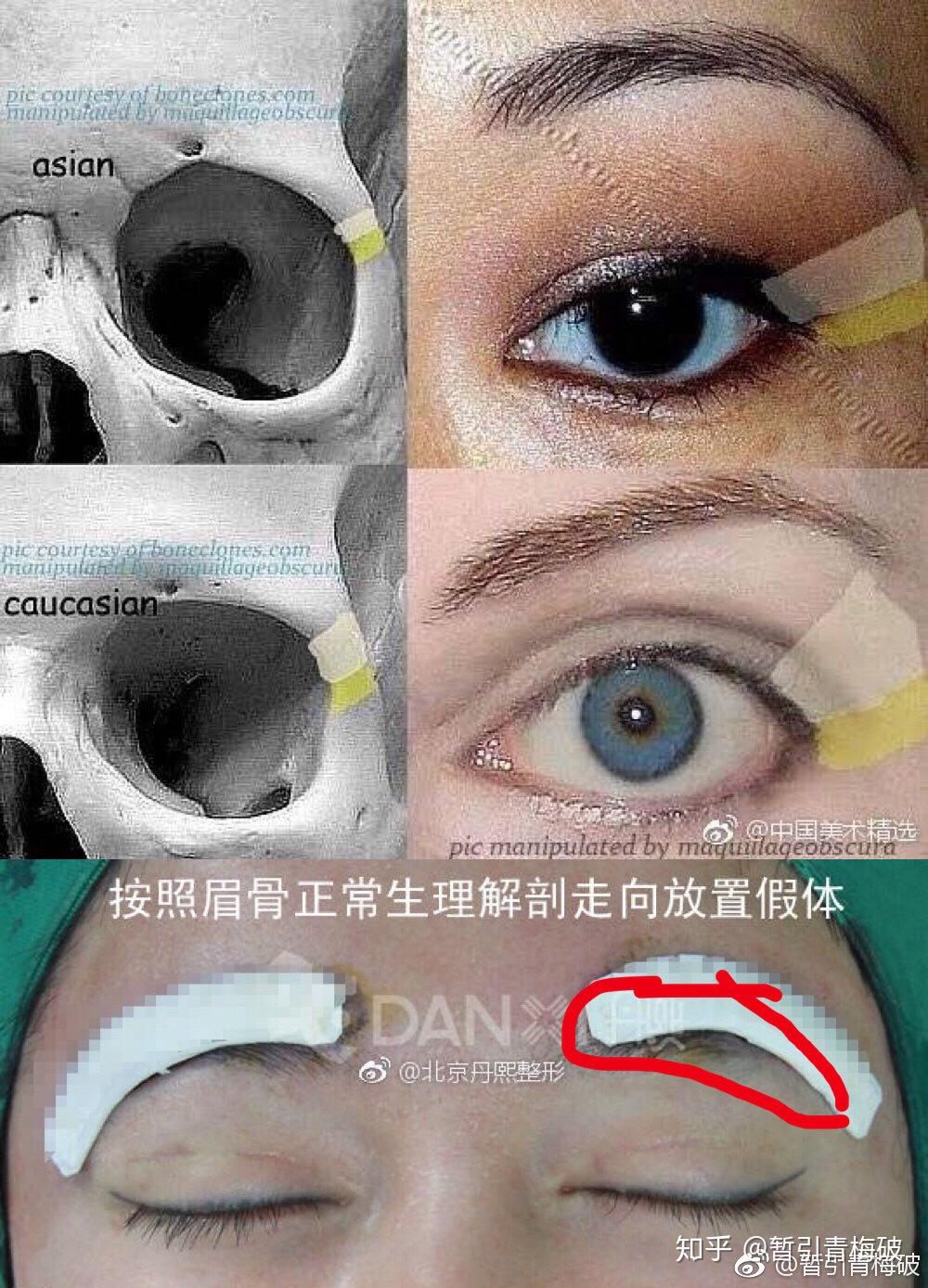 眉弓形态功课 - 知乎