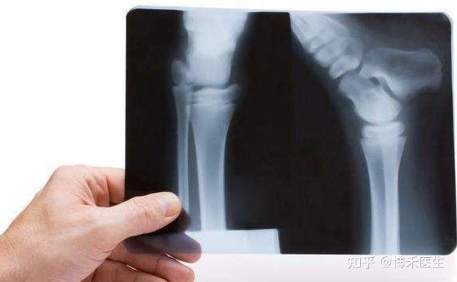 骨裂是不是一按就很疼