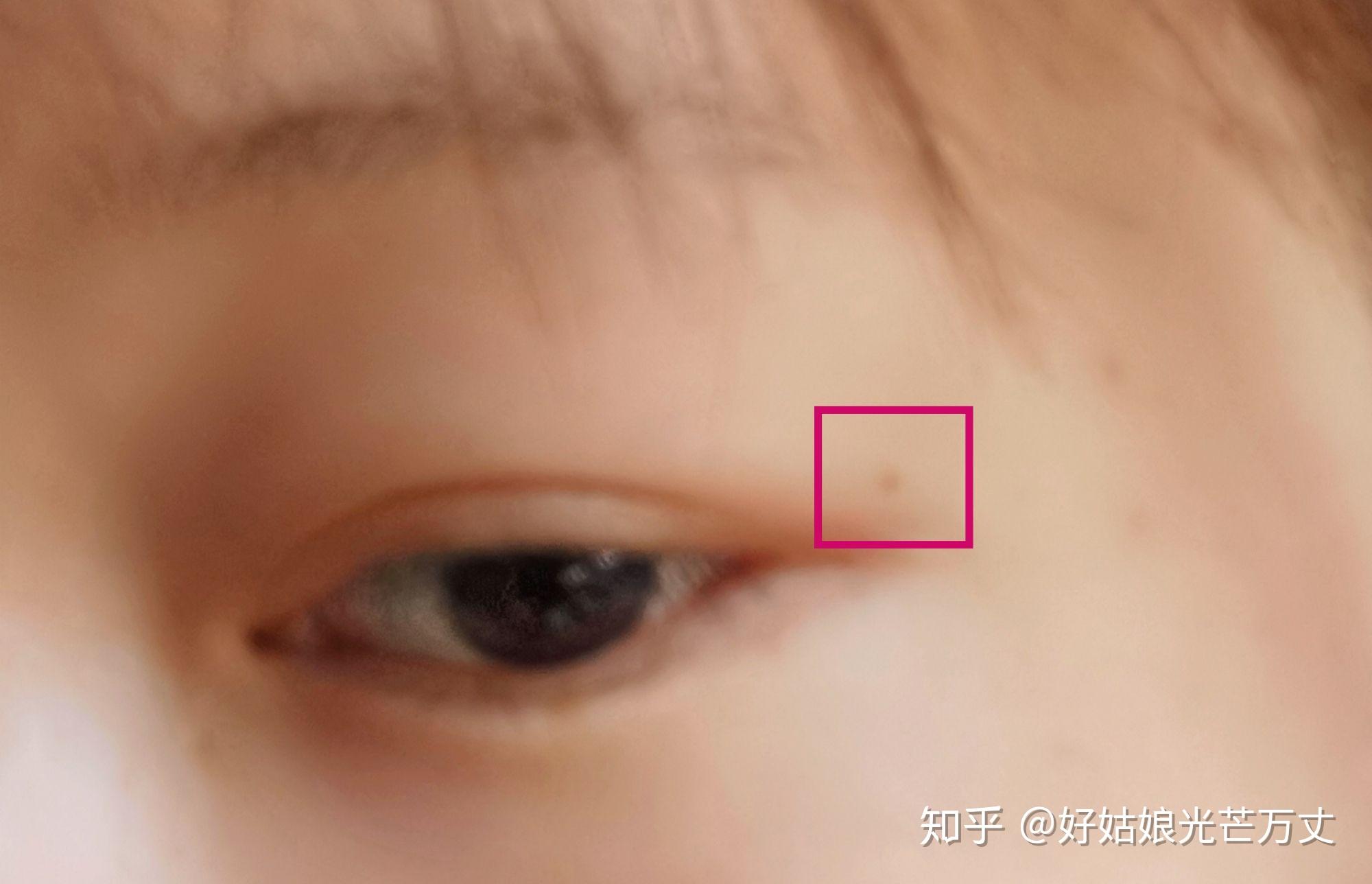 为什么有人说妖痣可怕妖痣究竟长在哪里