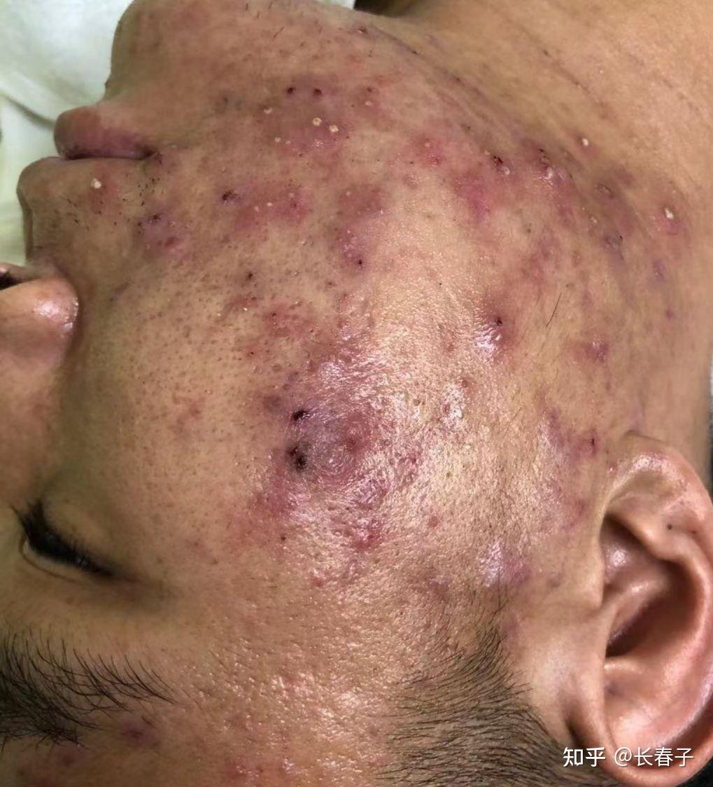 怎么能增加收入?