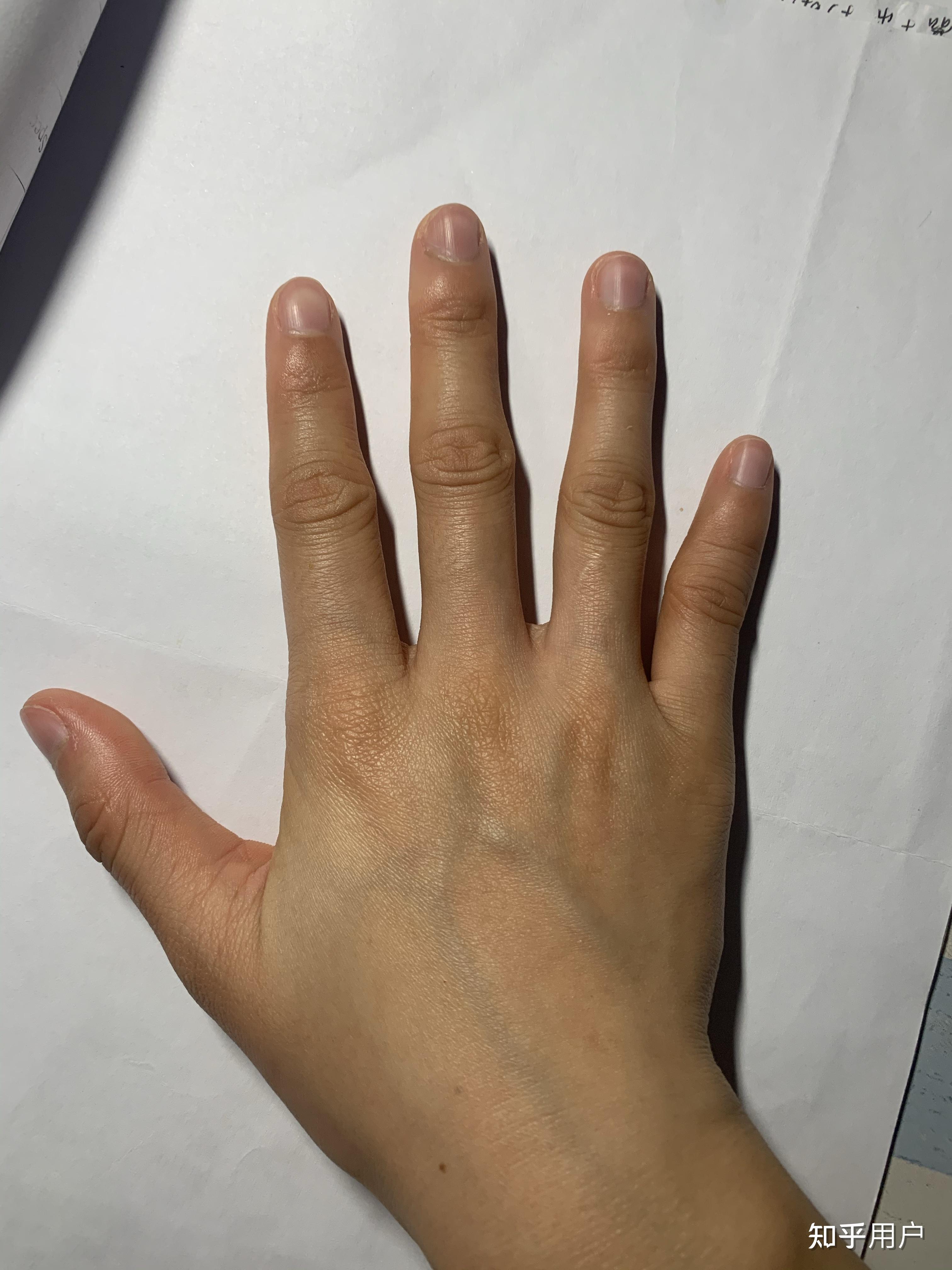 女生的手丑成这样怎么办? - 知乎