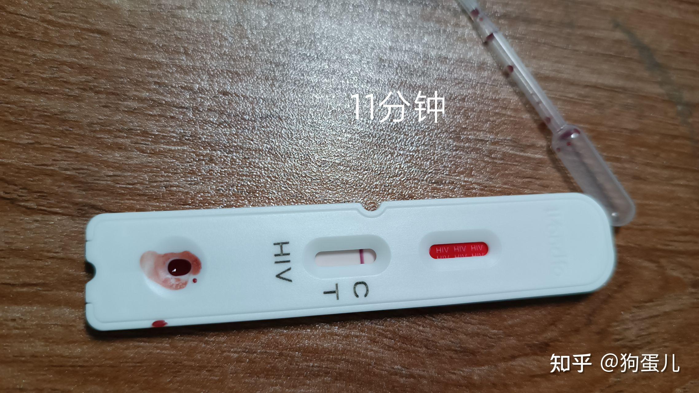 hiv试纸包埋线显色图片