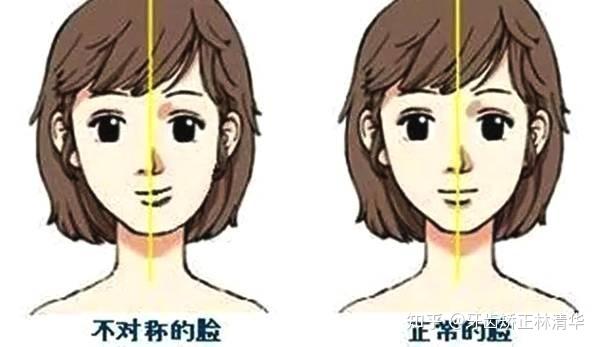 错颌畸形的病因详解 - 知乎