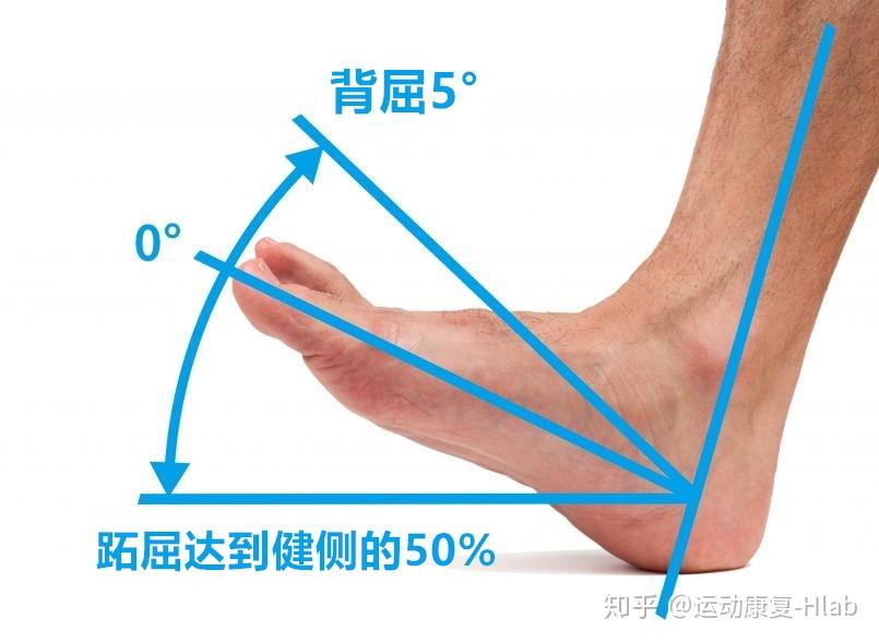 康复计划控制水肿疼痛增加踝关节活动度