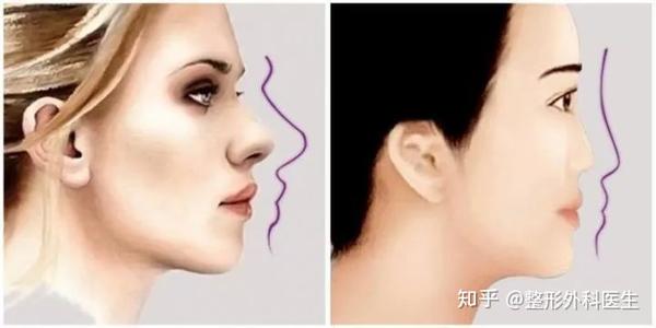 眉弓是哪里 什么样的人需要垫眉弓 知乎