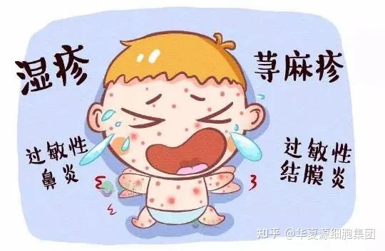 皮肤过敏的真正“原凶”竟然是我们自己的“免疫细胞”? - 知乎