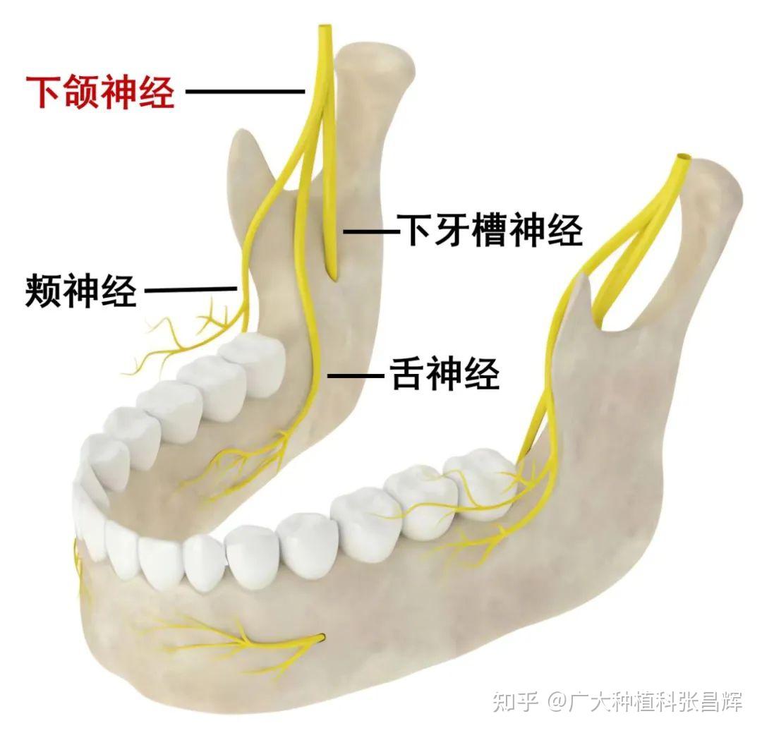 拔牙后的「危险」麻木感，要这样应对和处理#拔牙「并发症」 - 知乎