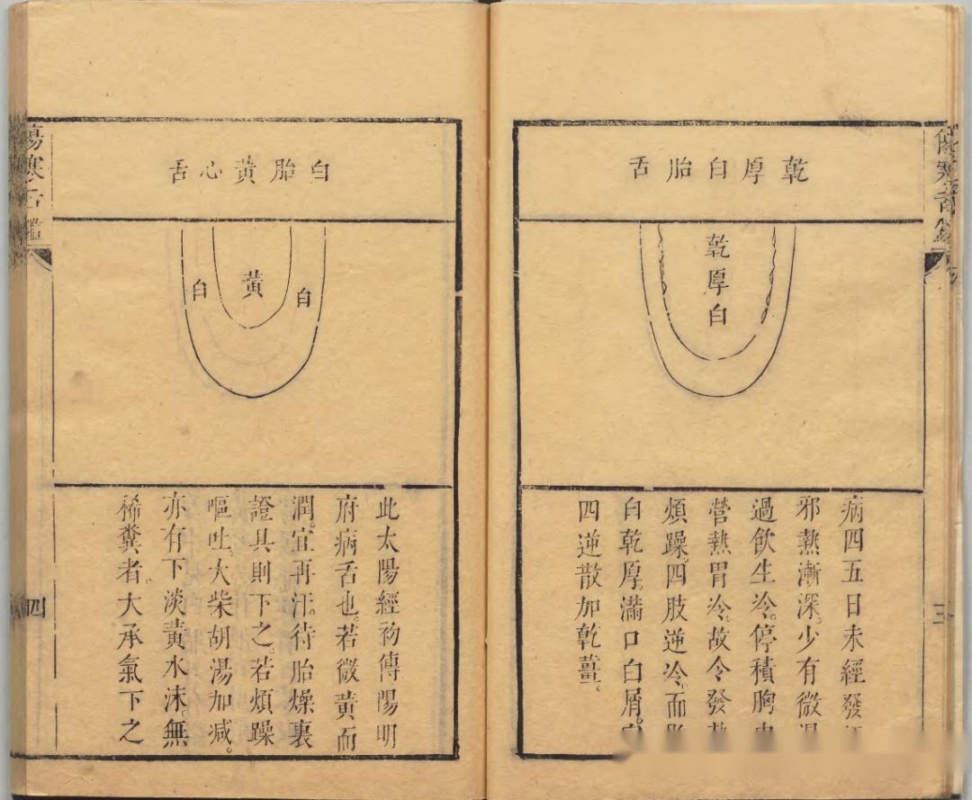 清康熙七年刻本舌诊著作伤寒舌鉴