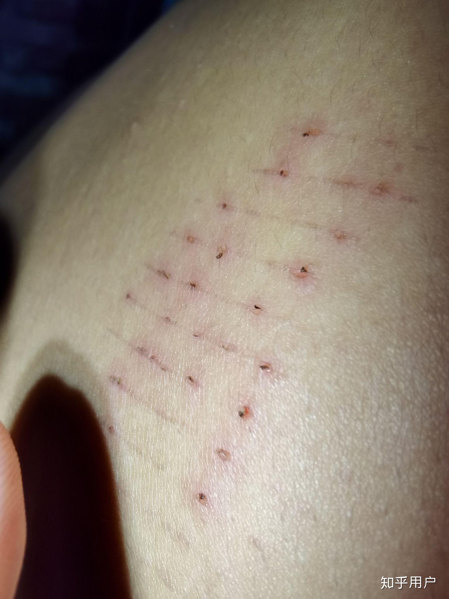 今天身上再次出现莫名划痕求解