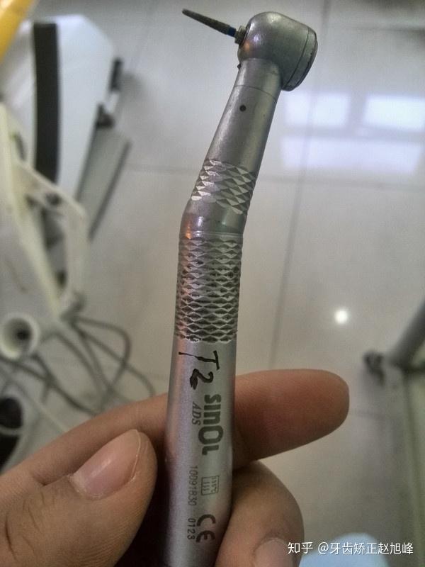 补牙在牙齿上钻个洞会不会更伤牙齿