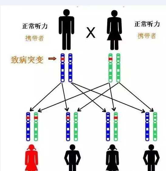 耳聋是遗传性疾病吗什么是遗传性耳聋