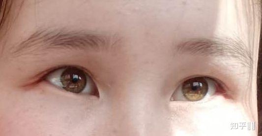 有哪些明星或普通人有像猫一样的眼睛