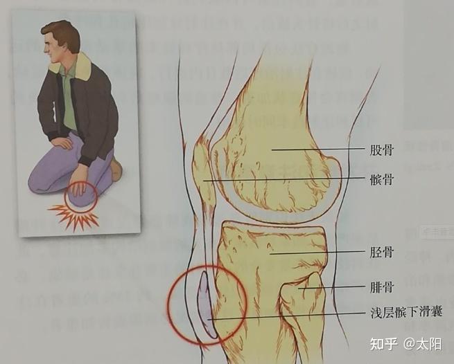 膝盖疼痛