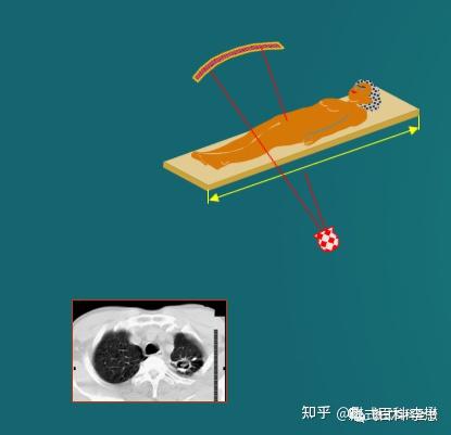 CT基础知识——扫描方式 - 知乎
