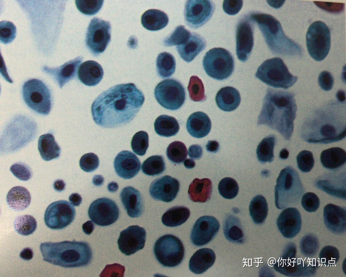 正如百科里面所说,ta是【液基薄层细胞检测】的简称,ta都包括了什么呢