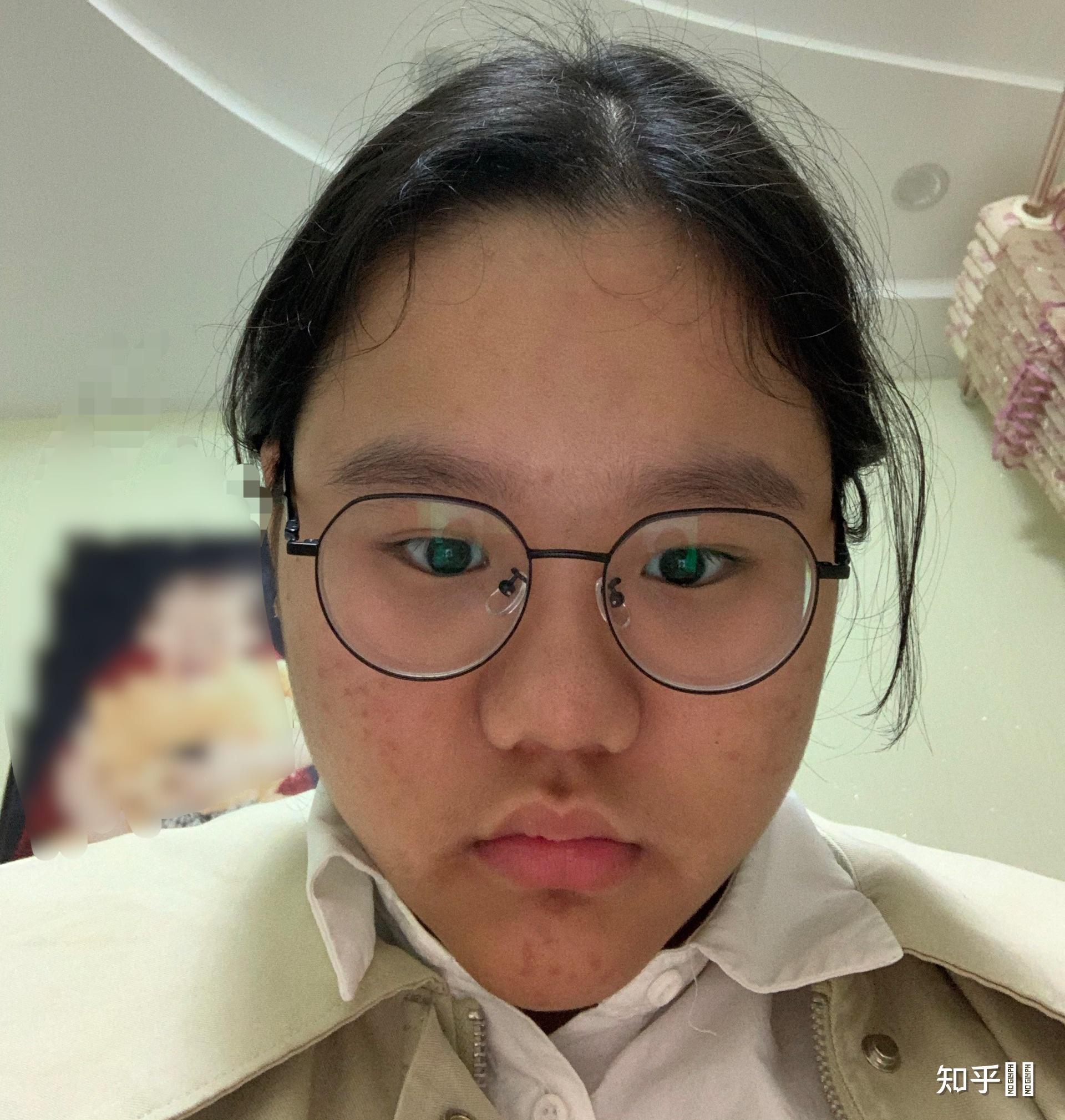 女生长得特别丑怎么办