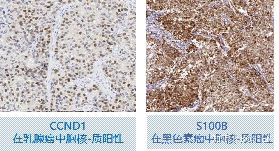 免疫组化(IHC)实验从入门要高阶一篇搞定 - 知乎