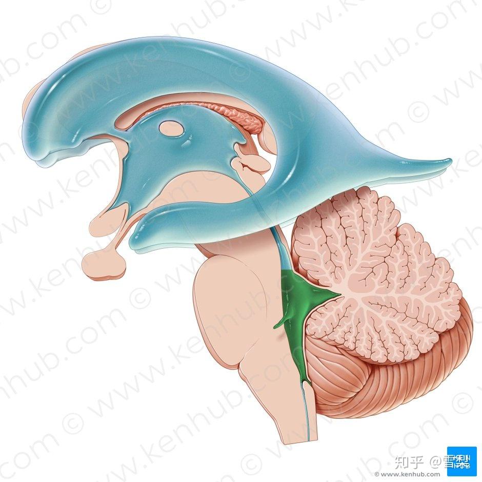 fourth ventriclethelateral wallsof the fourth ventricle are