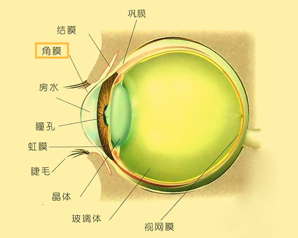 角膜缘干细胞缺乏症