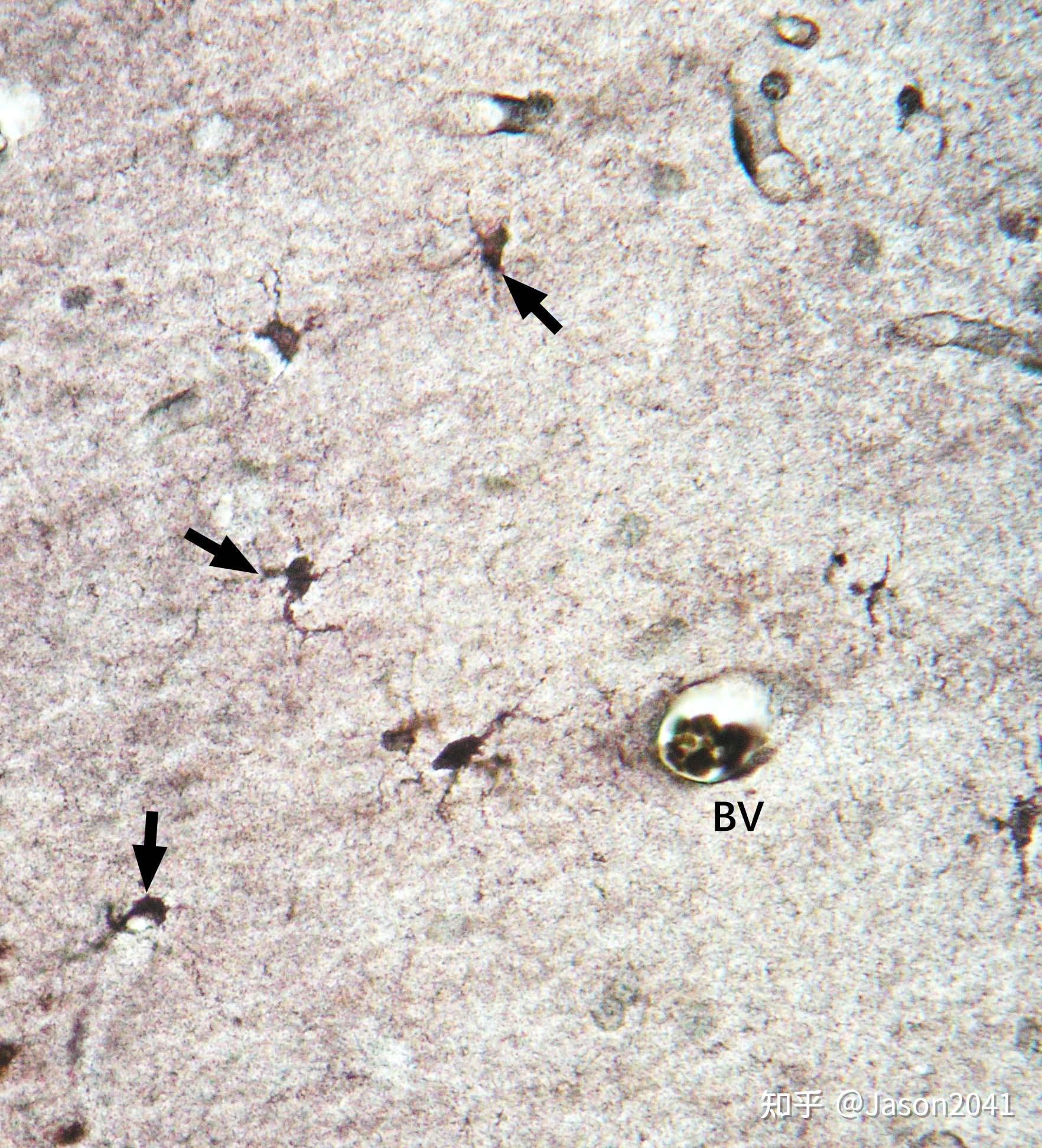 神经组织i-光镜下显示正常神经元和胶质细胞的方法