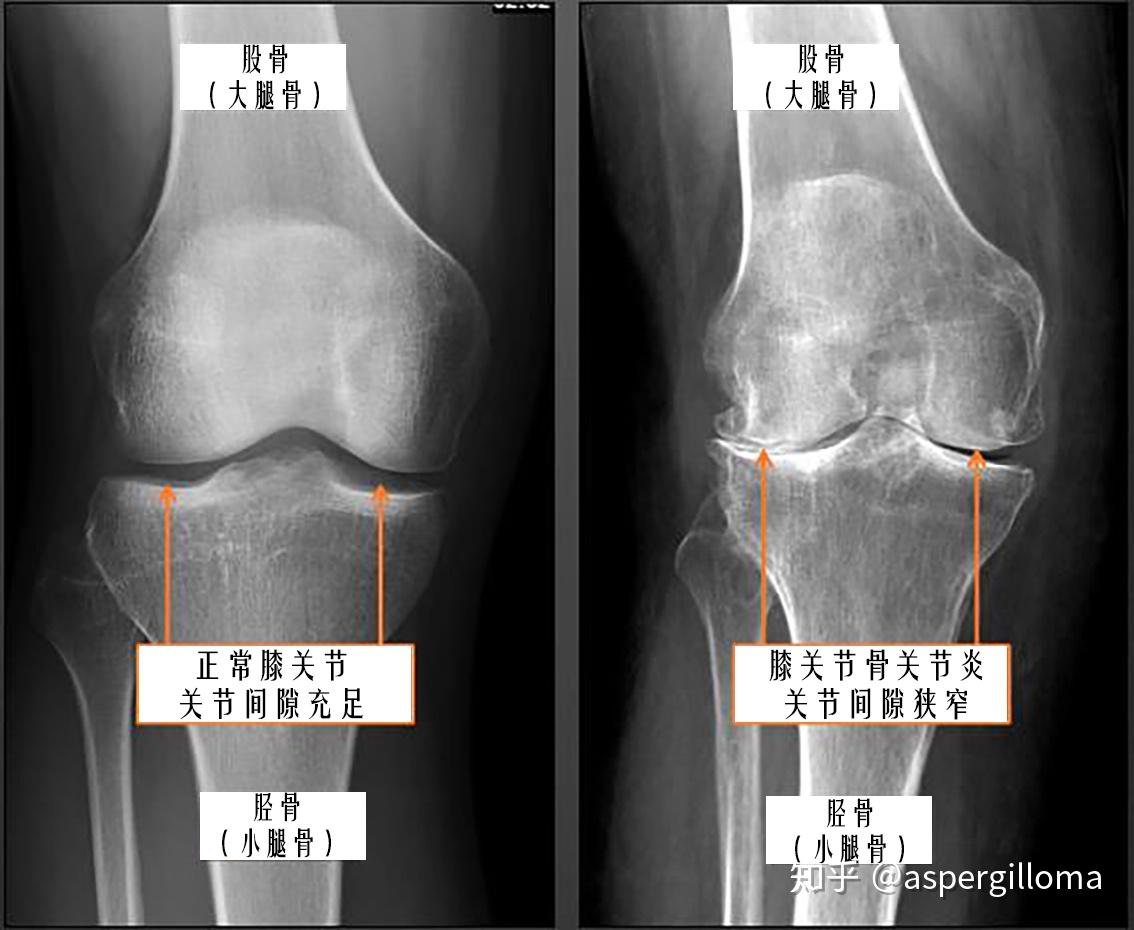 【原创】膝关节3D解剖图谱（一）