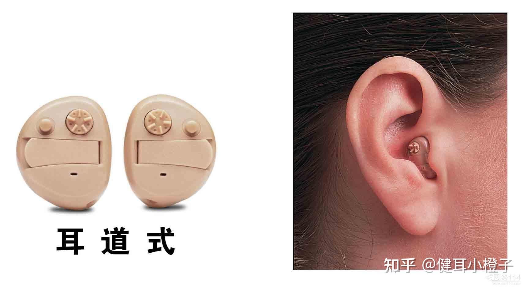 重点:助听器选哪个品牌 - 知乎