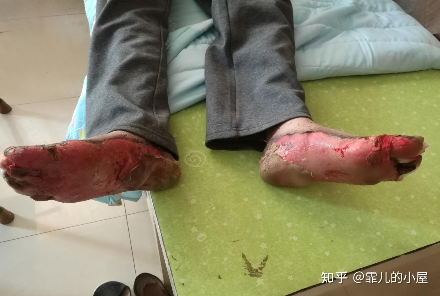 吸血鬼和僵尸真的存在吗？传说也是来源于生活- 知乎