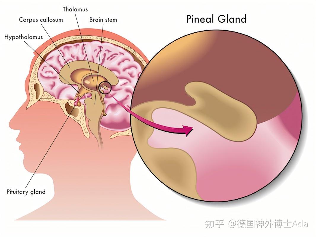 松果体横断图片