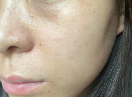 尤其是前段时间我疯狂加班熬夜,脸上皮肤状态明显变差了说句扎心的话