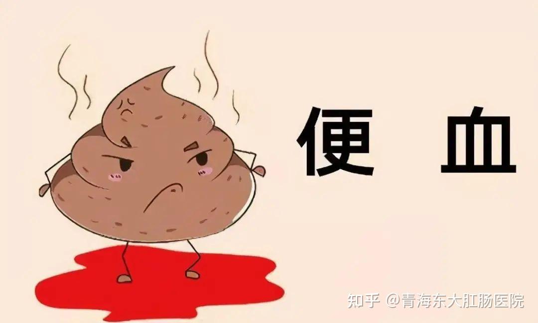 青海西宁看肛肠:便血、脱出、疼痛分别预示哪些肛门疾病? - 知乎