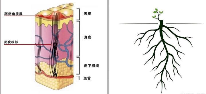 跖疣内部结构图片