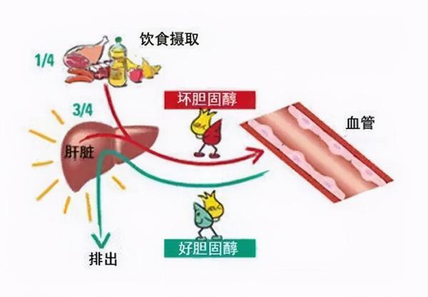 49岁,血脂高出10倍!喝酒活血降血脂?致胰腺炎,生命垂危