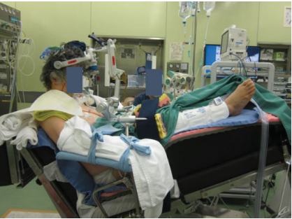 原发性延髓出血患者半坐位血肿清除术后呼吸抑制改善