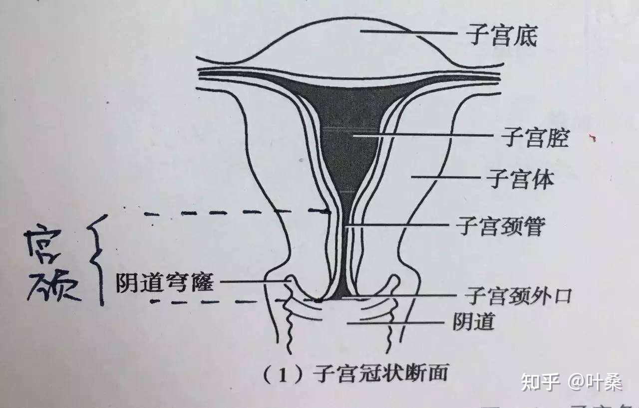 Sad uterus cartoon | Cervical cancer diagram with sadness uterus ...