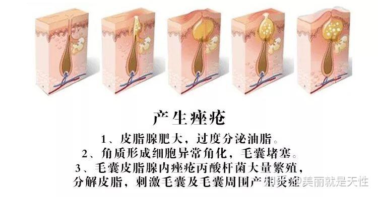 男性护肤应该怎样做才摆脱大油脸 - 知乎